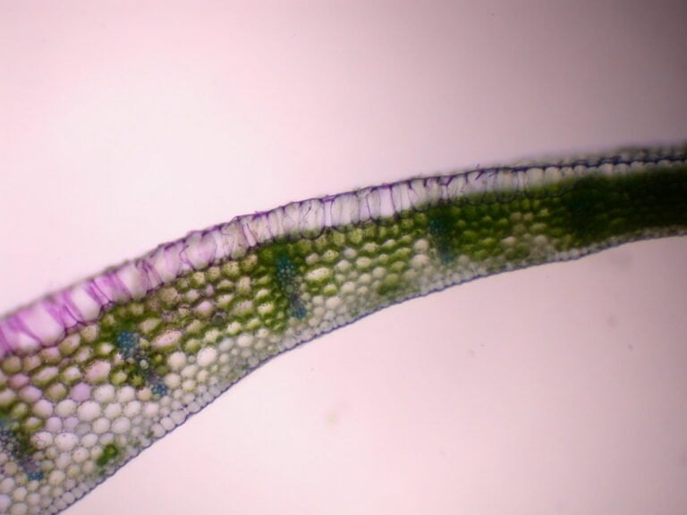 Microscopic view of a plant leaf cross-section showing cell structure with chloroplasts.